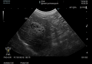 胆嚢のエコー写真